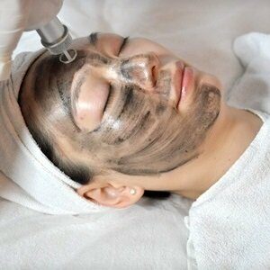 Carbon Laser Peeling